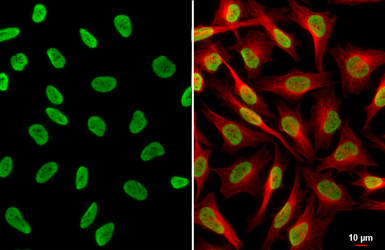 Anti-Histone H3K18ac (Acetyl Lys18) antibody used in Immunocytochemistry/ Immunofluorescence (ICC/IF). GTX128943