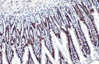 Anti-Histone H3K18ac (Acetyl Lys18) antibody used in IHC (Paraffin sections) (IHC-P). GTX128943