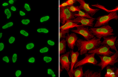 Anti-Histone H3K18ac (Acetyl Lys18) antibody used in Immunocytochemistry/ Immunofluorescence (ICC/IF). GTX128943
