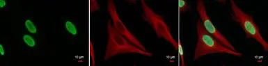 Anti-Histone H3K27ac (Acetyl Lys27) antibody used in Immunocytochemistry/ Immunofluorescence (ICC/IF). GTX128944