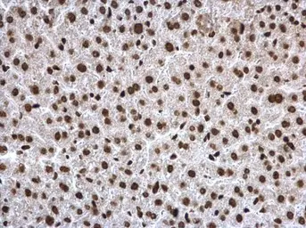 Anti-Histone H3K27ac (Acetyl Lys27) antibody used in IHC (Paraffin sections) (IHC-P). GTX128944