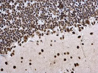 Anti-Histone H3K27ac (Acetyl Lys27) antibody used in IHC (Paraffin sections) (IHC-P). GTX128944
