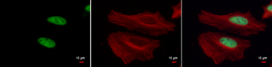 Anti-Histone H3K4me3 (Tri-methyl Lys4) antibody used in Immunocytochemistry/ Immunofluorescence (ICC/IF). GTX128954