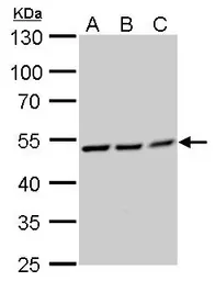 Anti-RUVBL2 antibody used in Western Blot (WB). GTX128975