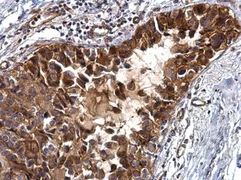 Anti-IGFBP2 antibody used in IHC (Paraffin sections) (IHC-P). GTX128977
