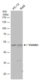 Anti-Visfatin antibody used in Western Blot (WB). GTX128980