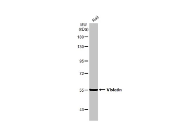 Anti-Visfatin antibody used in Western Blot (WB). GTX128980