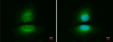 Anti-Visfatin antibody used in Immunocytochemistry/ Immunofluorescence (ICC/IF). GTX128980