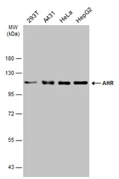 Anti-AHR antibody used in Western Blot (WB). GTX129013