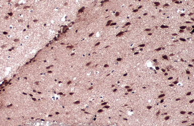 Anti-JARID2 antibody used in IHC (Paraffin sections) (IHC-P). GTX129019
