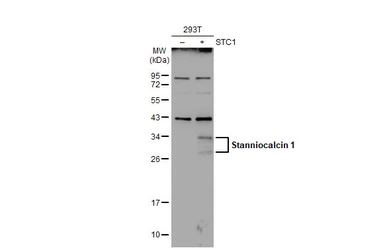 Anti-Stanniocalcin 1 antibody used in Western Blot (WB). GTX129092