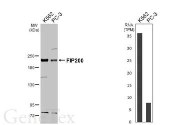 Anti-FIP200 antibody used in Western Blot (WB). GTX129093