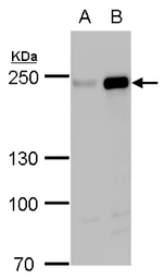 Anti-FIP200 antibody used in Western Blot (WB). GTX129093