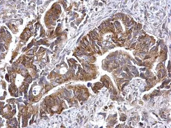 Anti-ATG16L1 antibody used in IHC (Paraffin sections) (IHC-P). GTX129098