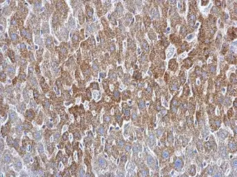 Anti-ATG16L1 antibody used in IHC (Paraffin sections) (IHC-P). GTX129098