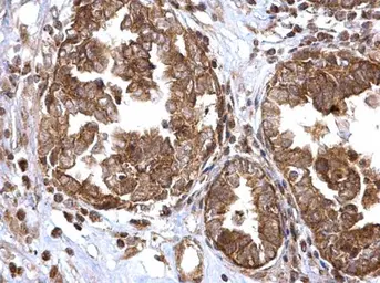 Anti-ATG16L1 antibody used in IHC (Paraffin sections) (IHC-P). GTX129098