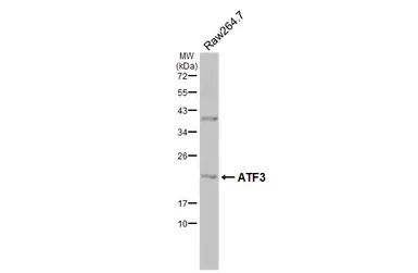 Anti-ATF3 antibody used in Western Blot (WB). GTX129120