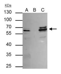 Anti-CDR2 antibody used in Immunoprecipitation (IP). GTX129122