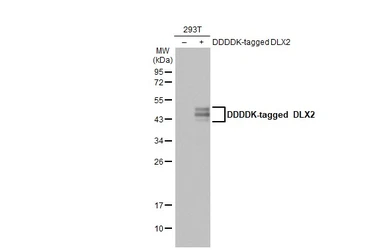 Anti-DLX2 antibody used in Western Blot (WB). GTX129123