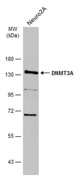 Anti-DNMT3A antibody used in Western Blot (WB). GTX129125