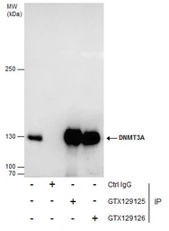 Anti-DNMT3A antibody used in Immunoprecipitation (IP). GTX129125