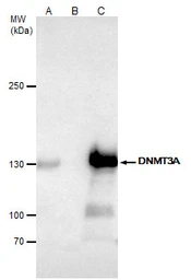 Anti-DNMT3A antibody used in Immunoprecipitation (IP). GTX129125