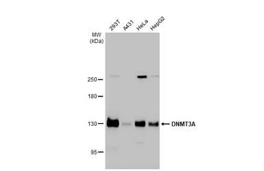 Anti-DNMT3A antibody used in Western Blot (WB). GTX129125