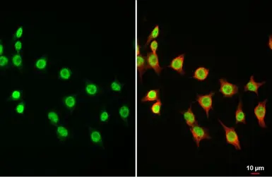 Anti-DNMT3A antibody used in Immunocytochemistry/ Immunofluorescence (ICC/IF). GTX129125