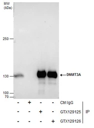 Anti-DNMT3A antibody used in Immunoprecipitation (IP). GTX129126