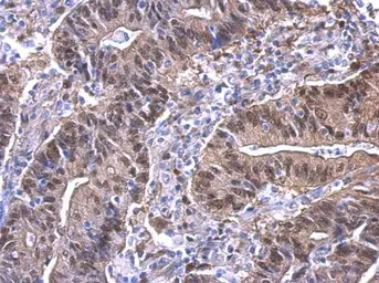 Anti-YAP1 antibody used in IHC (Paraffin sections) (IHC-P). GTX129151