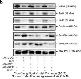 Anti-SUV39H2 antibody used in Western Blot (WB). GTX129167