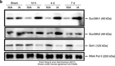 Anti-SUV39H2 antibody used in Western Blot (WB). GTX129167