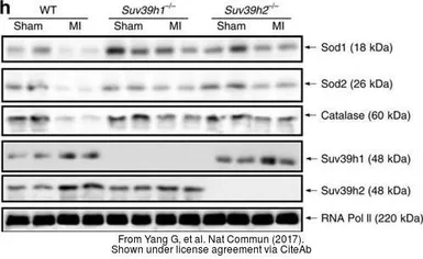Anti-SUV39H2 antibody used in Western Blot (WB). GTX129167