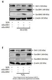 Anti-SUV39H2 antibody used in Western Blot (WB). GTX129167