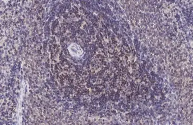 Anti-LEF1 antibody used in IHC (Paraffin sections) (IHC-P). GTX129186