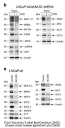 Anti-ASCL1 antibody used in Western Blot (WB). GTX129189
