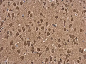 Anti-ASCL1 antibody used in IHC (Paraffin sections) (IHC-P). GTX129189