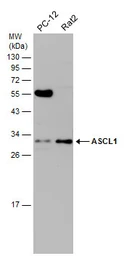 Anti-ASCL1 antibody used in Western Blot (WB). GTX129189