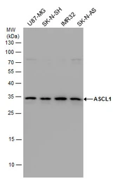 Anti-ASCL1 antibody used in Western Blot (WB). GTX129189