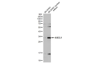 Anti-ASCL1 antibody used in Western Blot (WB). GTX129189