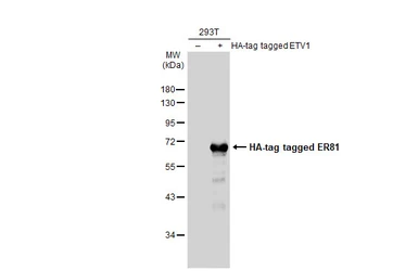 Anti-ER81 antibody used in Western Blot (WB). GTX129202