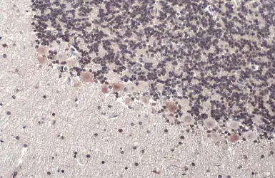 Anti-ER81 antibody used in IHC (Paraffin sections) (IHC-P). GTX129202