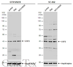 Anti-USF2 antibody used in Western Blot (WB). GTX129239