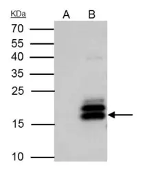 Anti-MAFK antibody used in Immunoprecipitation (IP). GTX129240