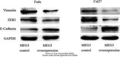Anti-ZEB2 antibody used in Western Blot (WB). GTX129243