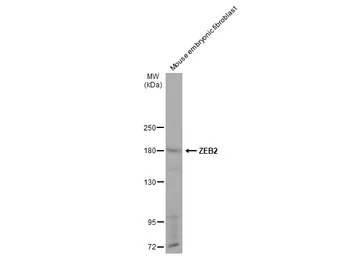 Anti-ZEB2 antibody used in Western Blot (WB). GTX129243