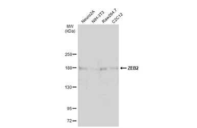 Anti-ZEB2 antibody used in Western Blot (WB). GTX129243