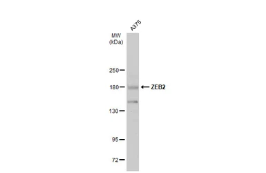 Anti-ZEB2 antibody used in Western Blot (WB). GTX129243