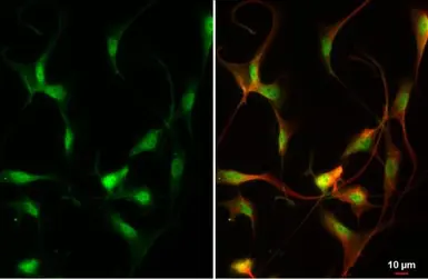 Anti-ZEB2 antibody used in Immunocytochemistry/ Immunofluorescence (ICC/IF). GTX129243