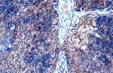 Anti-ZEB2 antibody used in IHC (Paraffin sections) (IHC-P). GTX129243